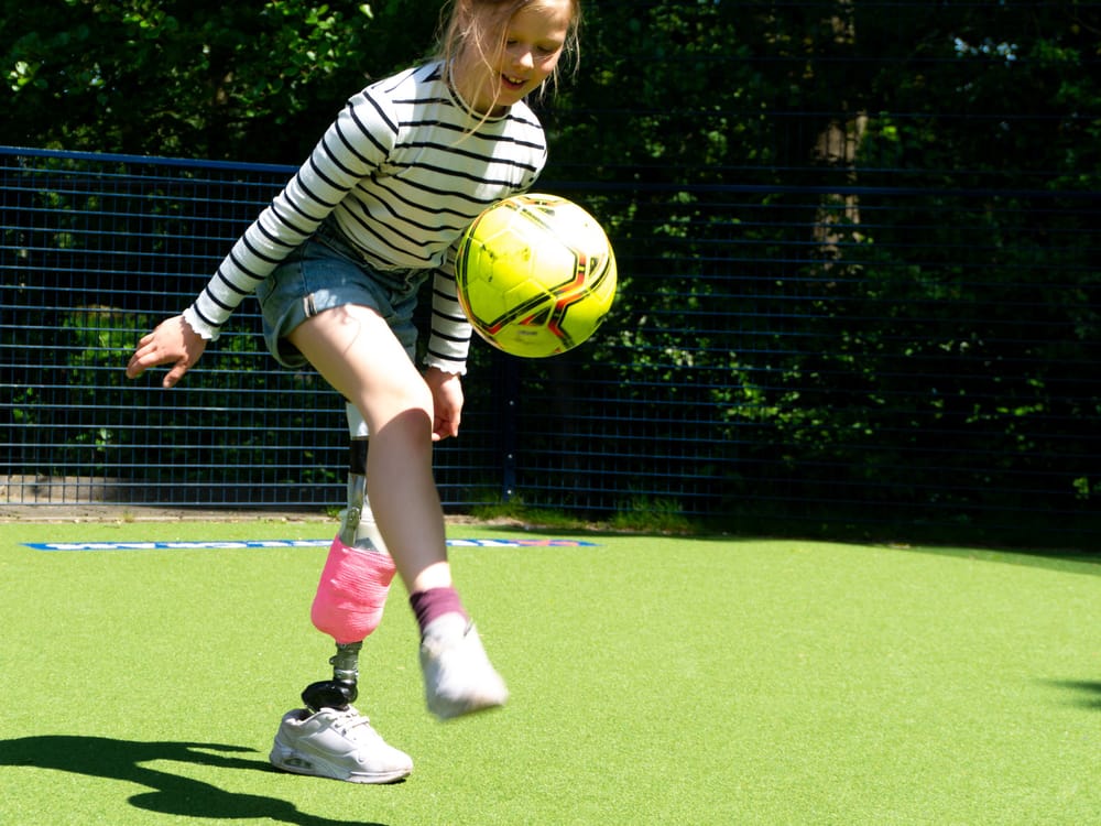 Prosthetic foot that grows with the child