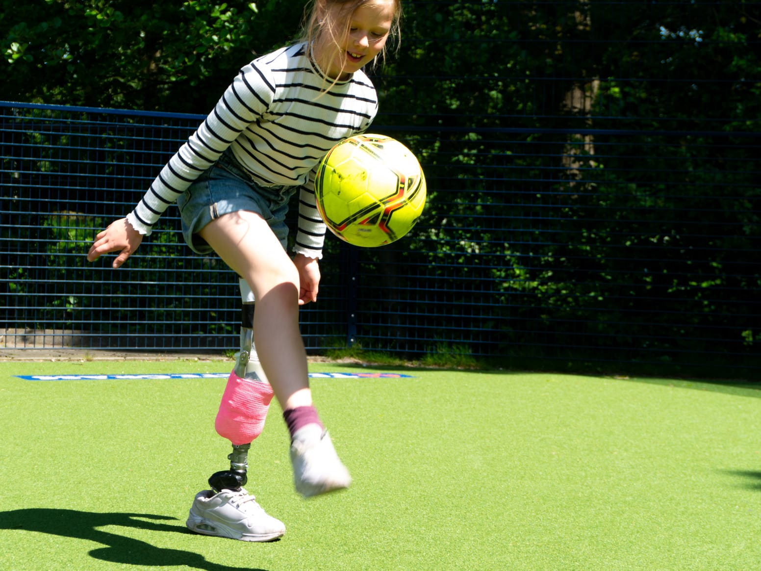 Photo of a girl playing football while balancing on her prosthetic foot from Gyromotics